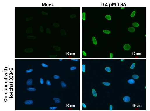 H2AK5ac Antibody in Immunocytochemistry (ICC/IF)