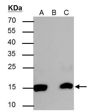 H2BK20ac Antibody in Immunoprecipitation (IP)