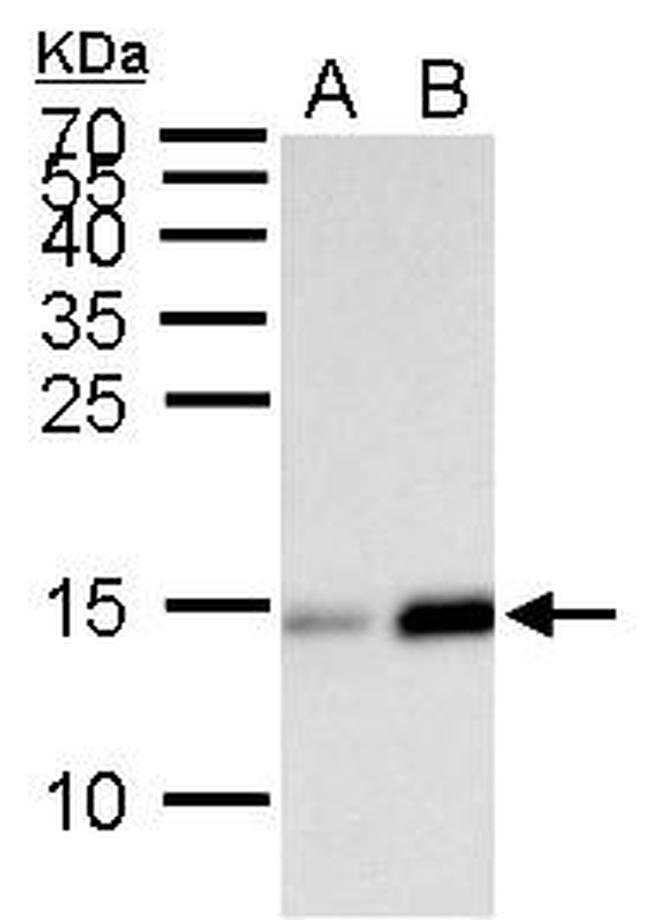 H2BK20ac Antibody in Western Blot (WB)