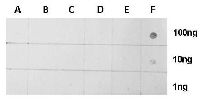 H2AK5ac Antibody in Dot Blot (DB)