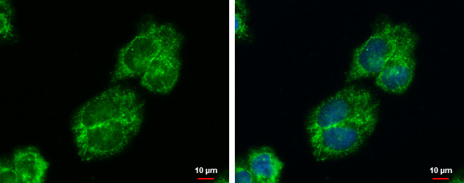 IGFBP2 Antibody in Immunocytochemistry (ICC/IF)