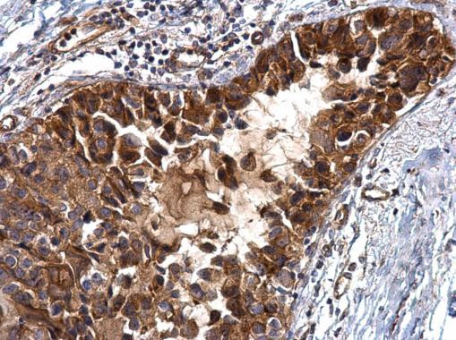 IGFBP2 Antibody in Immunohistochemistry (Paraffin) (IHC (P))