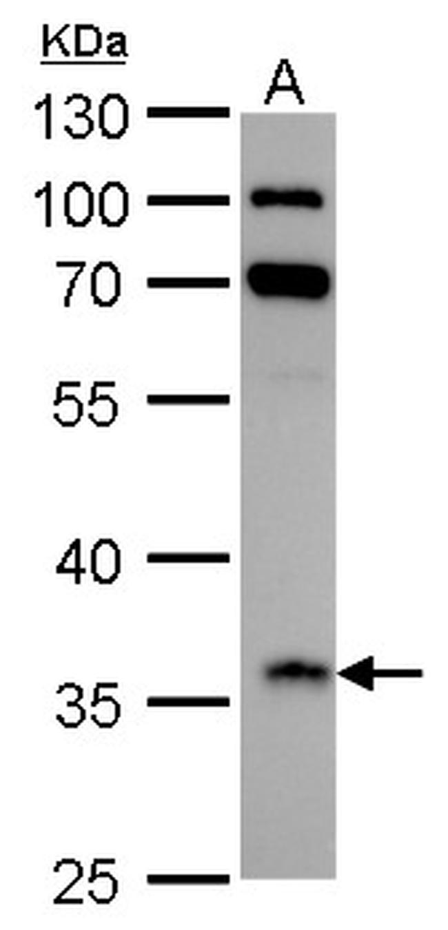 IGFBP2 Antibody in Western Blot (WB)