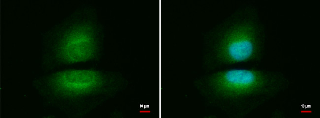 NAMPT Antibody in Immunocytochemistry (ICC/IF)