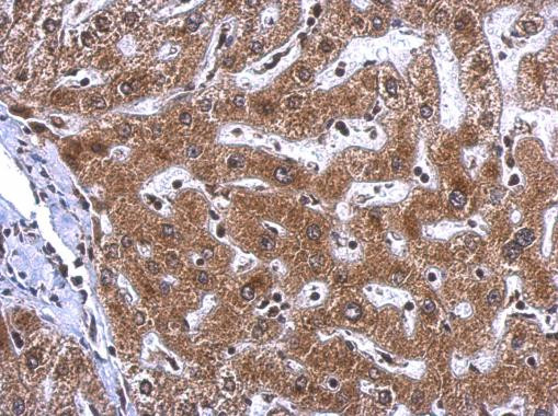 NAMPT Antibody in Immunohistochemistry (Paraffin) (IHC (P))