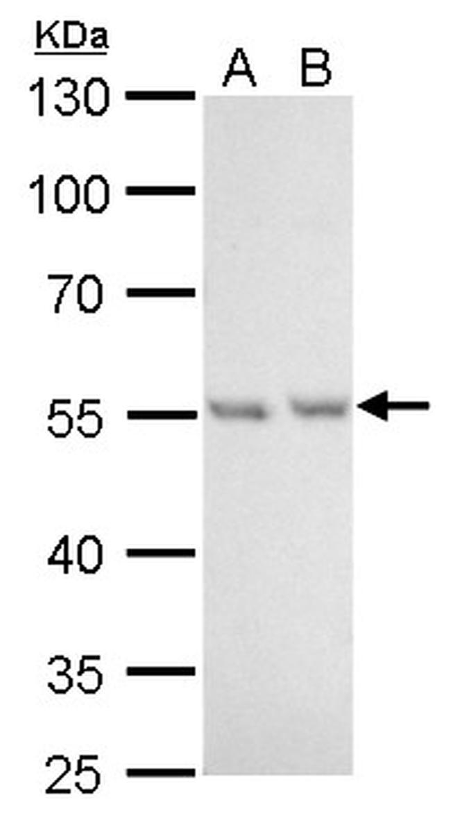 NAMPT Antibody in Western Blot (WB)