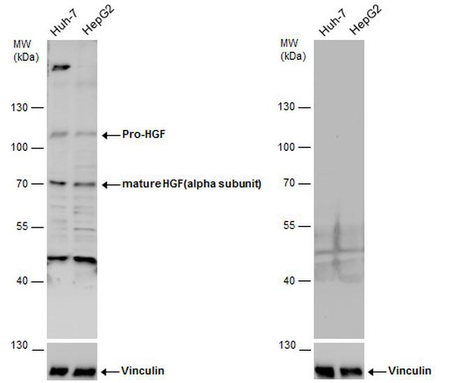 HGF Antibody in Western Blot (WB)