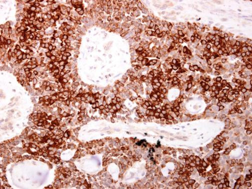 AHR Antibody in Immunohistochemistry (Paraffin) (IHC (P))