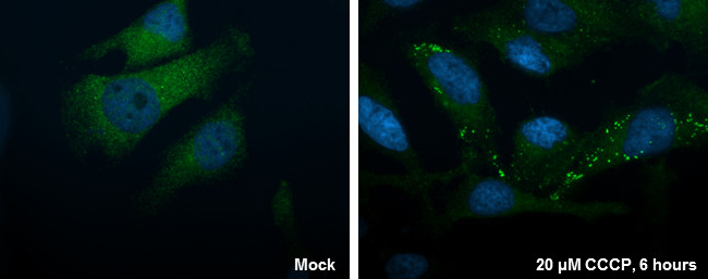 ATG16L1 Antibody in Immunocytochemistry (ICC/IF)