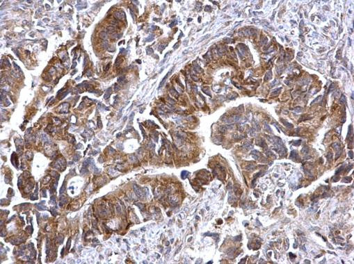 ATG16L1 Antibody in Immunohistochemistry (Paraffin) (IHC (P))