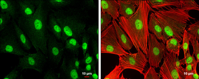 RUNX1 Antibody in Immunocytochemistry (ICC/IF)