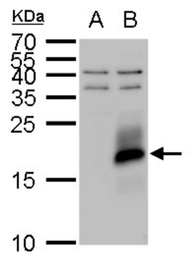 IGF2 Antibody in Western Blot (WB)