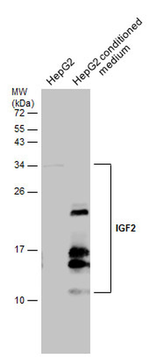 IGF2 Antibody in Western Blot (WB)