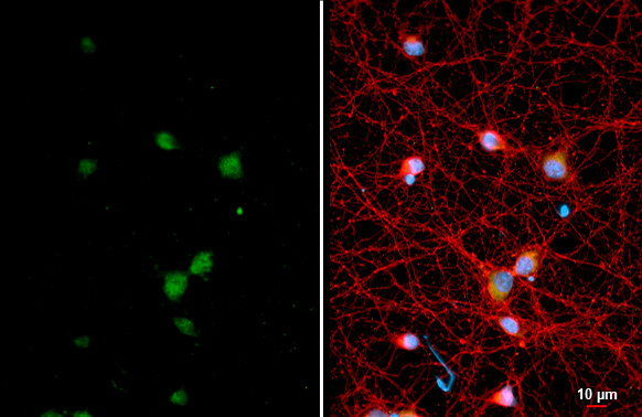 DLX2 Antibody in Immunocytochemistry (ICC/IF)