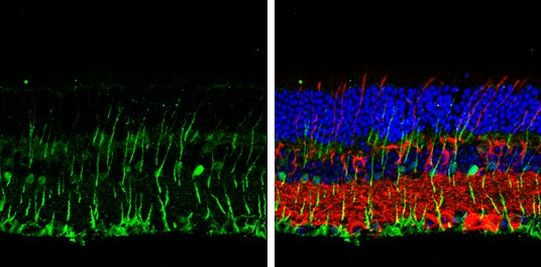 DLX2 Antibody in Immunohistochemistry (Paraffin) (IHC (P))