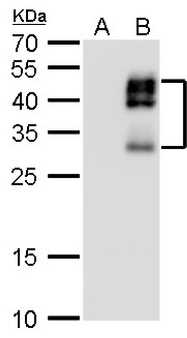 DLX2 Antibody in Western Blot (WB)