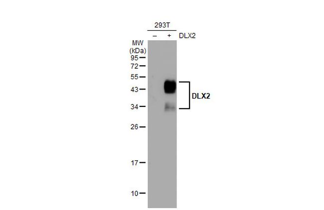 DLX2 Antibody in Western Blot (WB)