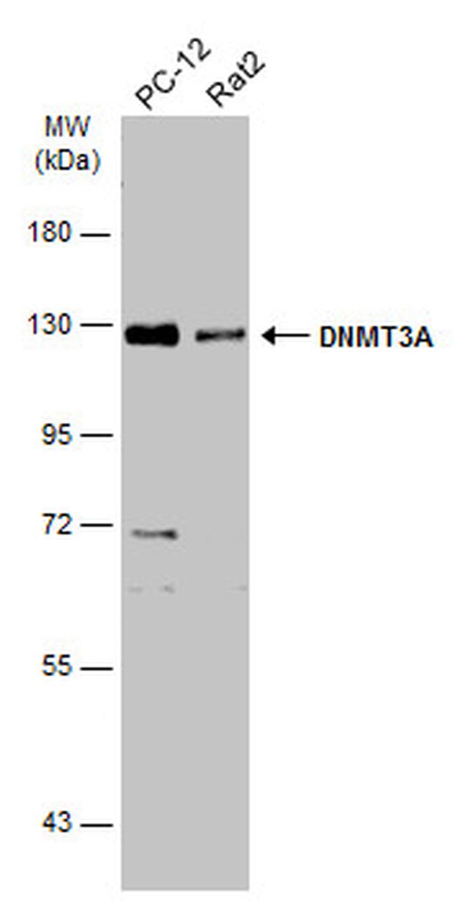 DNMT3A Antibody in Western Blot (WB)