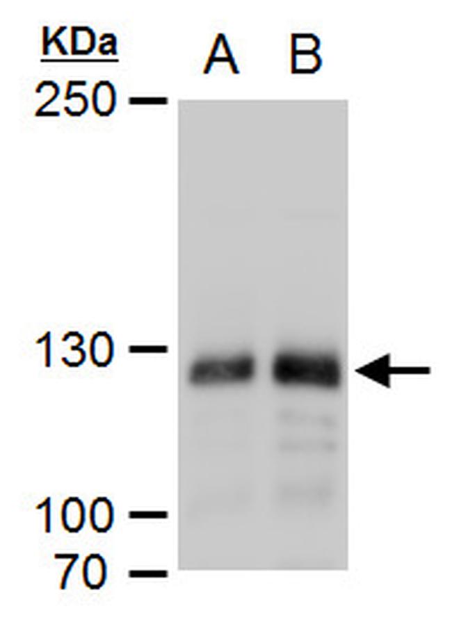 DNMT3A Antibody in Western Blot (WB)