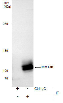 DNMT3B Antibody in Immunoprecipitation (IP)