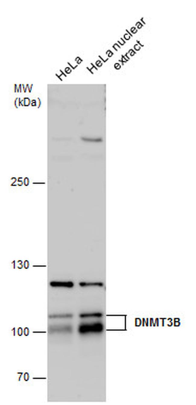 DNMT3B Antibody in Western Blot (WB)