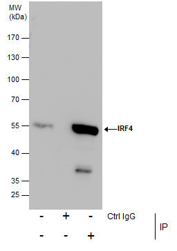 IRF4 Antibody in Immunoprecipitation (IP)
