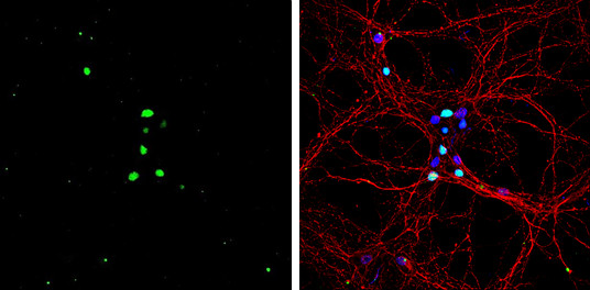 PROX1 Antibody in Immunocytochemistry (ICC/IF)