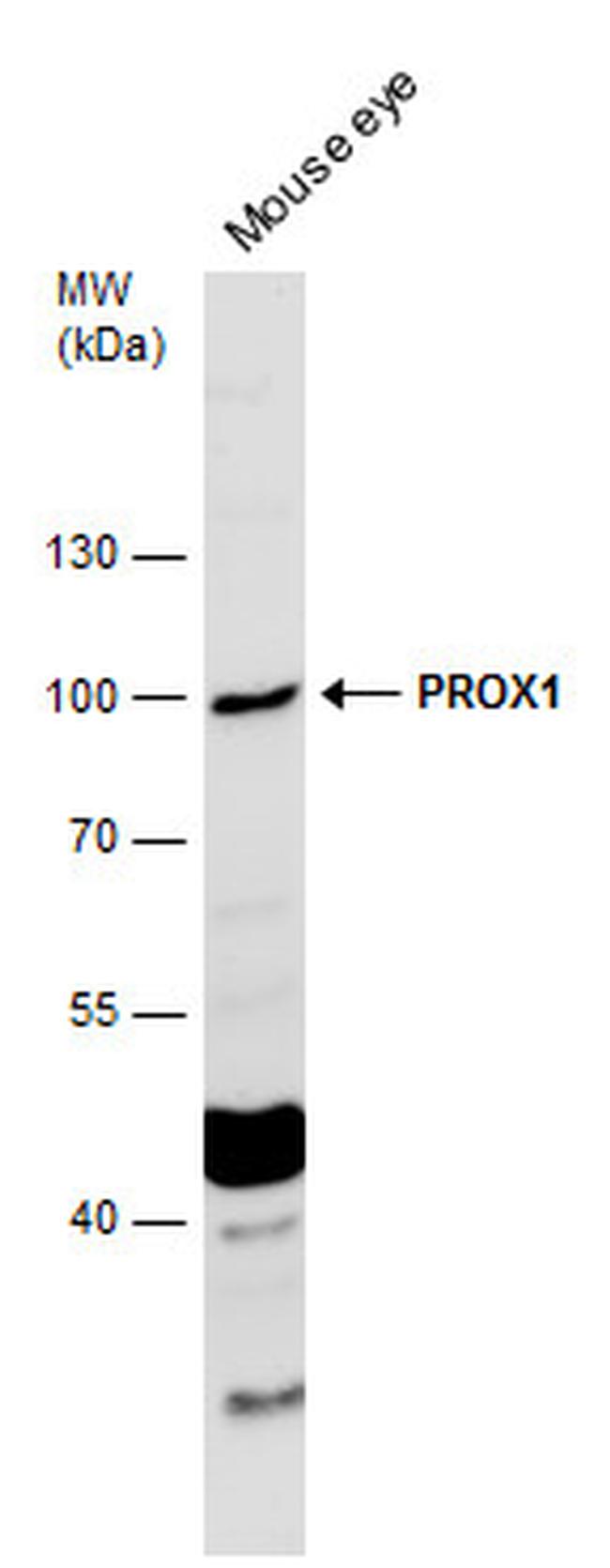PROX1 Antibody in Western Blot (WB)