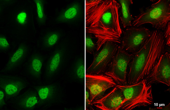 SIN3A Antibody in Immunocytochemistry (ICC/IF)