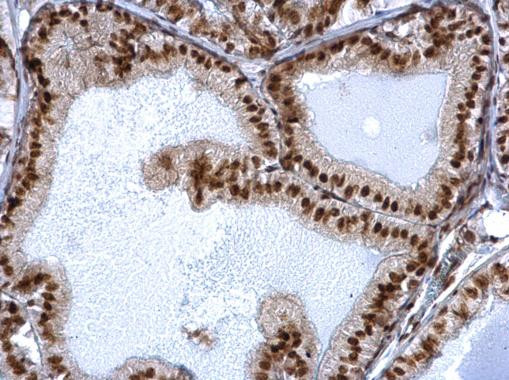 SIN3A Antibody in Immunohistochemistry (Paraffin) (IHC (P))