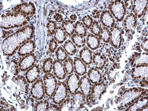 SIN3A Antibody in Immunohistochemistry (Paraffin) (IHC (P))