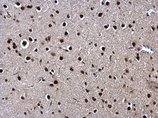 SIN3A Antibody in Immunohistochemistry (Paraffin) (IHC (P))