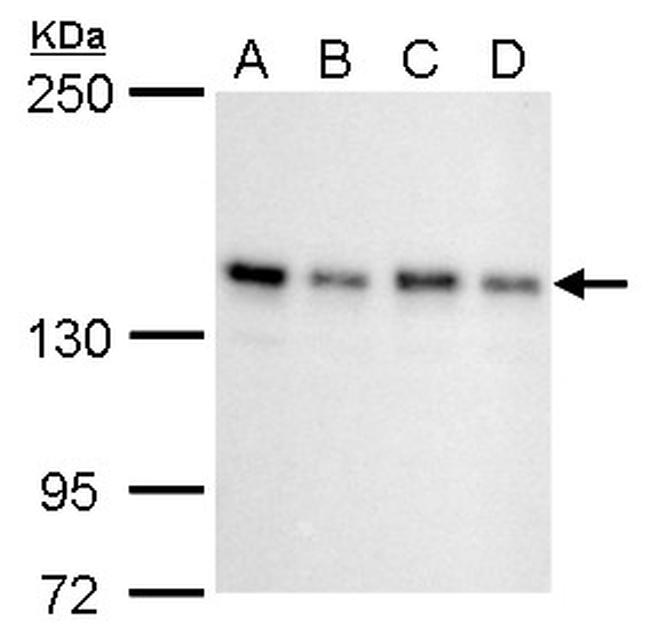 SIN3A Antibody in Western Blot (WB)