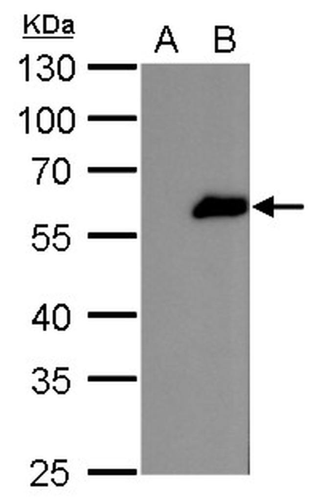 FOXJ1 Antibody in Western Blot (WB)