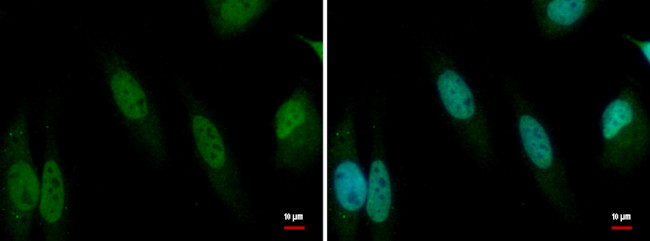 CITED2 Antibody in Immunocytochemistry (ICC/IF)