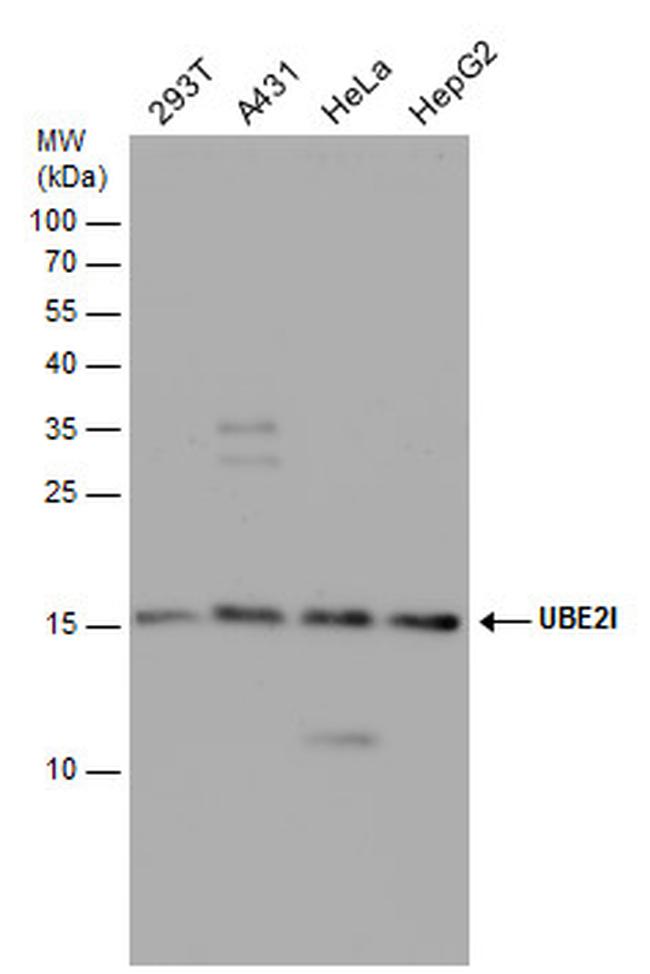 UBC9 Antibody in Western Blot (WB)