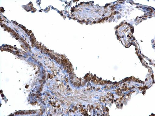 BDP Antibody in Immunohistochemistry (Paraffin) (IHC (P))