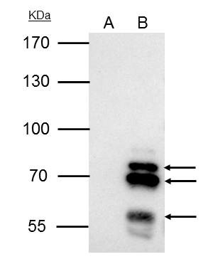 IKAROS Antibody in Immunoprecipitation (IP)