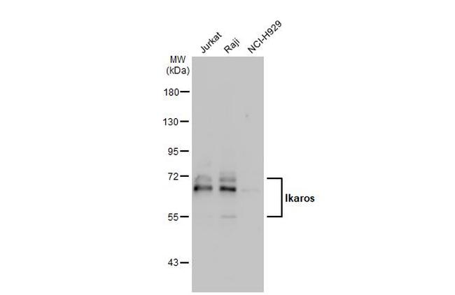 IKAROS Antibody in Western Blot (WB)