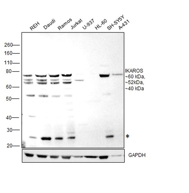 IKAROS Antibody in Western Blot (WB)