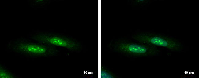 C1D Antibody in Immunocytochemistry (ICC/IF)