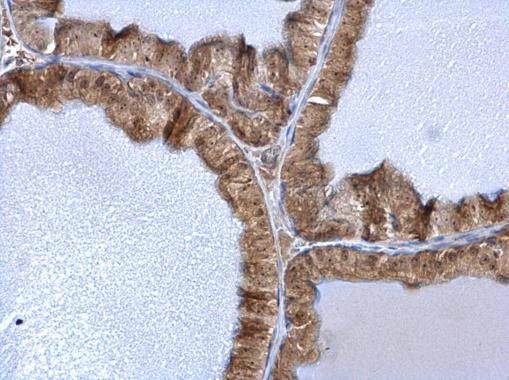 C1D Antibody in Immunohistochemistry (Paraffin) (IHC (P))