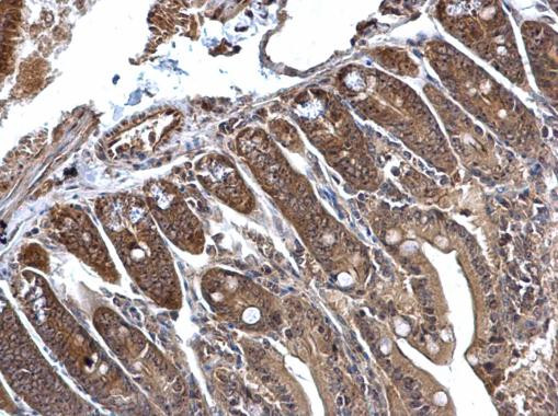 C1D Antibody in Immunohistochemistry (Paraffin) (IHC (P))