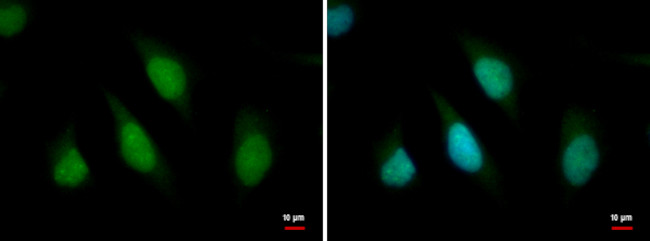 ARID2 Antibody in Immunocytochemistry (ICC/IF)