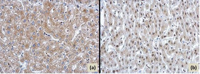 ARID2 Antibody in Immunohistochemistry (Paraffin) (IHC (P))