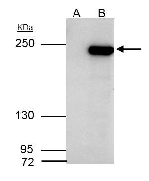 ARID2 Antibody in Immunoprecipitation (IP)