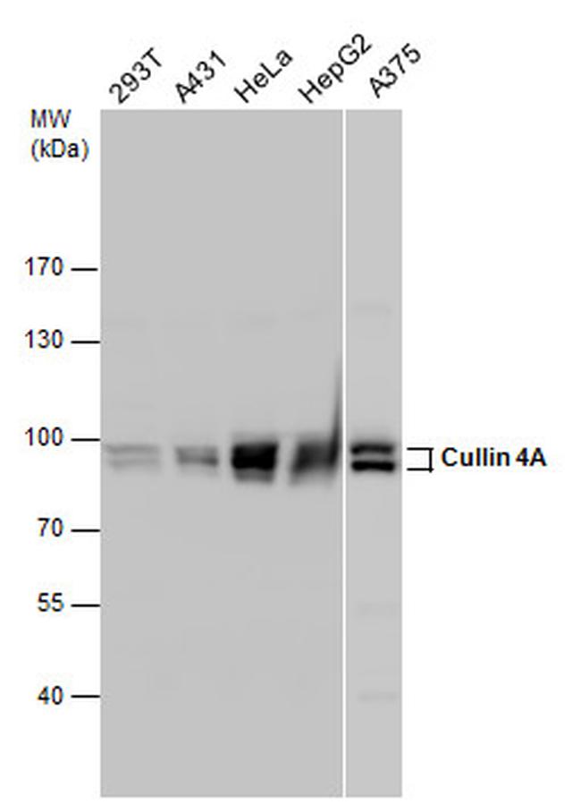 Cullin 4A Antibody in Western Blot (WB)