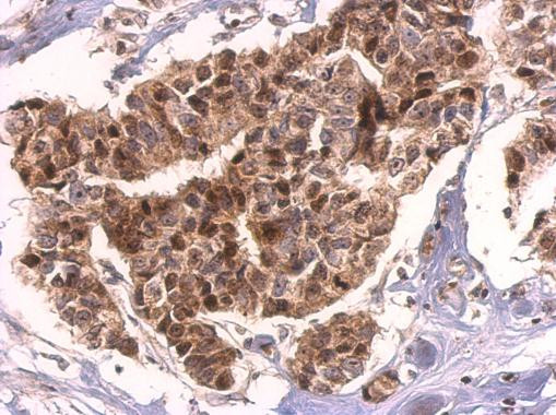 HMGB2 Antibody in Immunohistochemistry (Paraffin) (IHC (P))