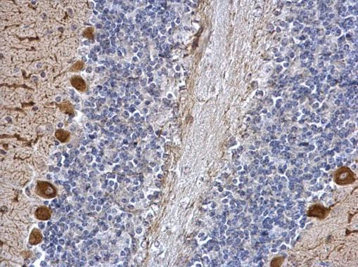 ICMT Antibody in Immunohistochemistry (Paraffin) (IHC (P))