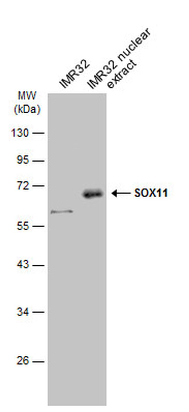 SOX11 Antibody in Western Blot (WB)